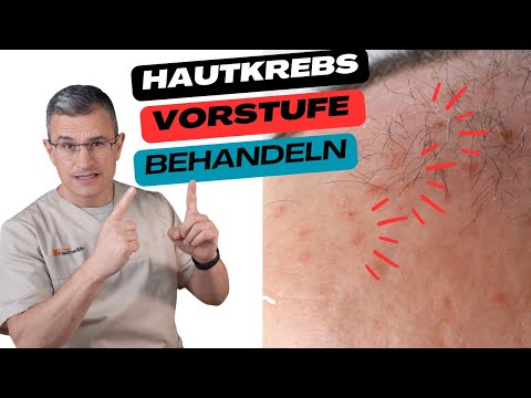 AKTINISCHE KERATOSE - Frühstadium behandeln