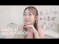 Radical Acceptance (it will change your life + set you free)