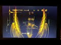 Alien Quadrilogy 2003 DVD Menu Walkthrough Disc 8 One Step Beyond
