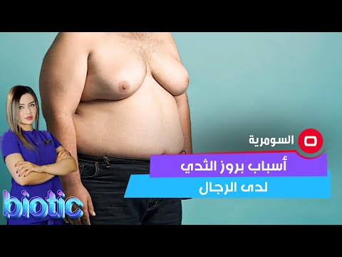 شاهد بالفيديو.. أسباب بروز الثدي لدى الرجال