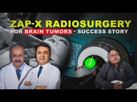 ZAP-X Radiosurgery Procedure for Brain Tumors Success Stories | Brain Tumors Treatment