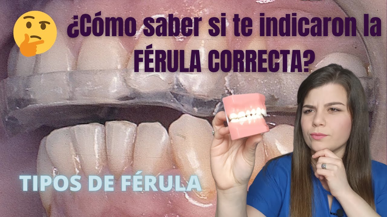 Watch Cual es la MEJOR ferula de descarga dental en 2022 🦷🏆 Now Cual es la MEJOR ferula de descarga dental en 2022 🦷🏆