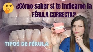 Cual es la MEJOR ferula de descarga dental en 2022 🦷🏆