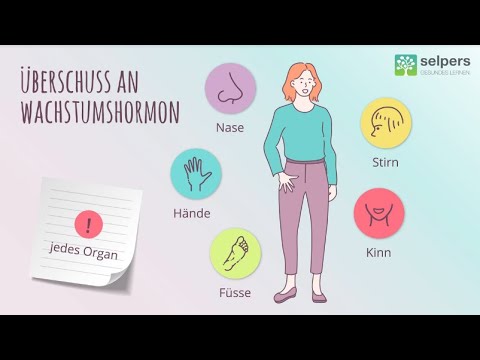 Was führt zu Akromegalie? Ursachen für zu viel Wachstumshormon