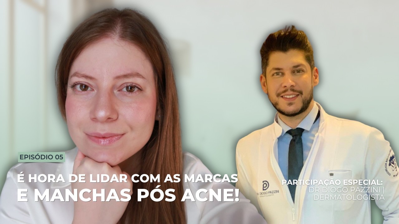 Manchas e Marcas Pós-Acne: Como Prevenir e Tratar com Sucesso | A Jornada da Sua Pele