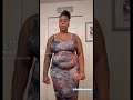 Before And After Tummy Tuck Results By Dr William