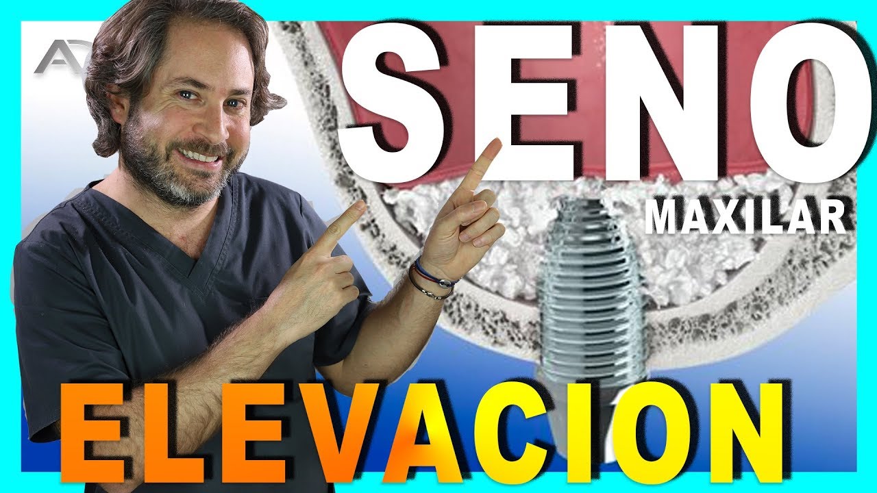 Juan Carlos Sánchez Pérez-70