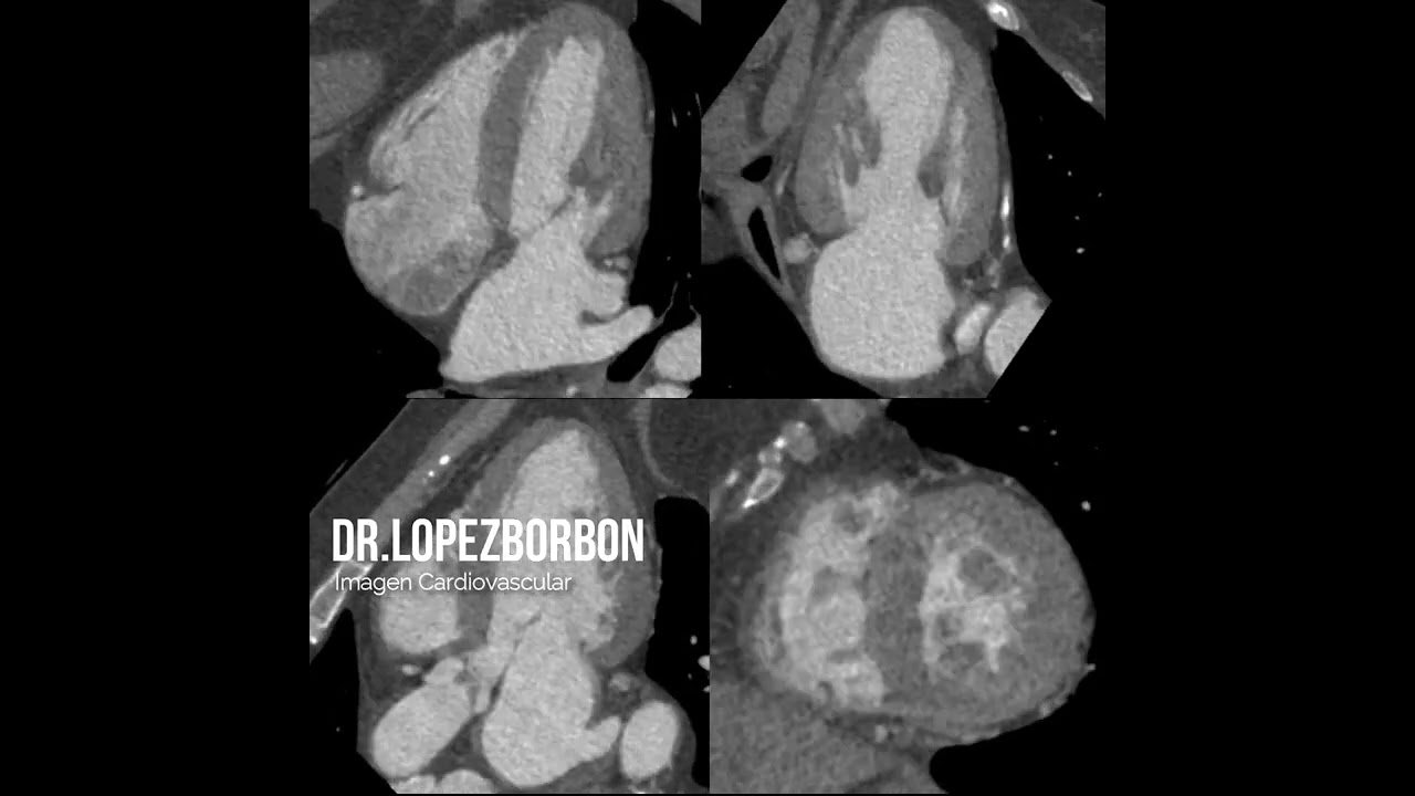 Jesús Francisco López Borbón-12