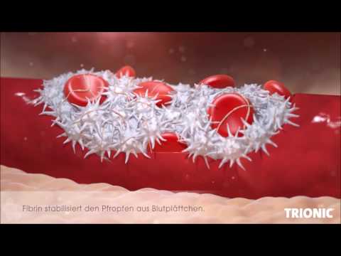 4M TRIONIC HÄMOSTASE