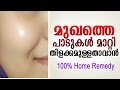 മുഖം വെട്ടിത്തിളങ്ങാൻ | home remedy for skin whitening | latest malayalam health