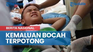 Download lagu Kemaluan Bocah Terpotong Saat Sunatan Massal di Riau mp3