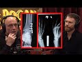 Scary Injuries From MMA Fights