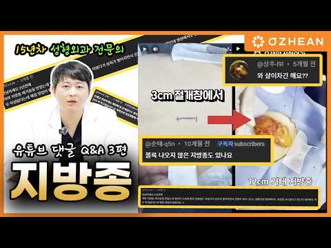 Q.지방종 "수술 없이 자연치유 될까요?" "수술 후 살이 차나요?" 지방종에 대한 모든 질문 Q&amp;A