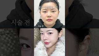 남찍사 잘나오는 볼류마이징 📸