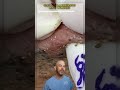TONS Of Blackheads Get Poked Out In This Video Credit Pimplepoppersatisfying On TT Doctor