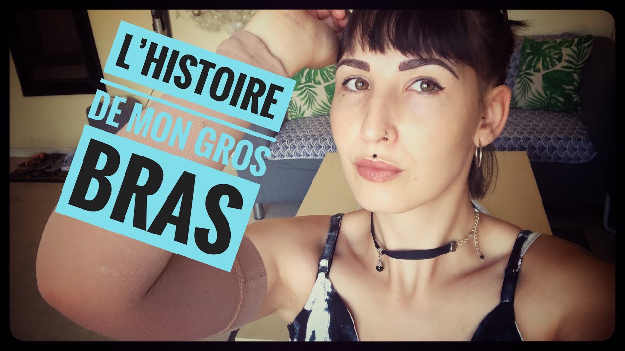 Watch Manchon De Compression Bras Oedeme Now Lymphoedème : comment va mon bras