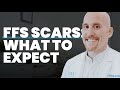 Does Facial Feminization Surgery Leave Scars What To Expect