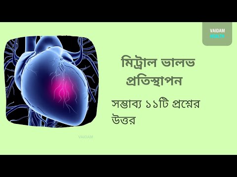 মিট্রাল ভালভ প্রতিস্থাপন- ১১ টি প্রায়শই জিজ্ঞাসিত প্রশ্ন