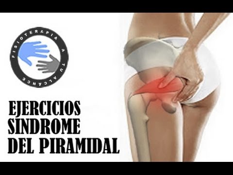 Ejercicios Para El Síndrome Del Piramidal