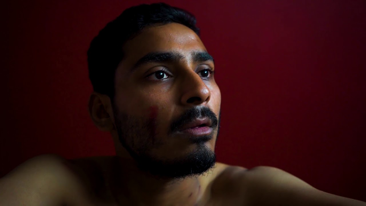 Investigations of A Dog