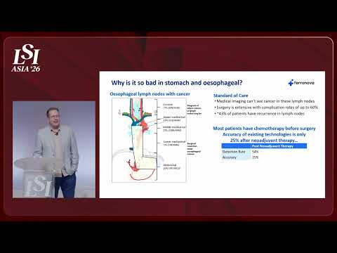 Stewart Bartlett, Ferronova Pty Ltd - Nanoparticle Detection of High-Risk Lymph Nodes | LSI Asia '26