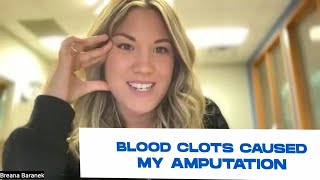 A Dramatic Battle With Blood Clots! | Running 5Ks To Losing My Leg