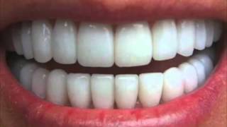 Get Perfectly Straight Teeth―∎ affirmations | Cure Overbite, Underbite & Crossbite