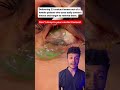 NEVER SLEEP WITH YOUR CONTACT LENSES Shorts Mbbs Neet Raj Bhosle