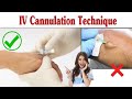 Intravenous Cannulation Technique || IV Cannula Procedure
