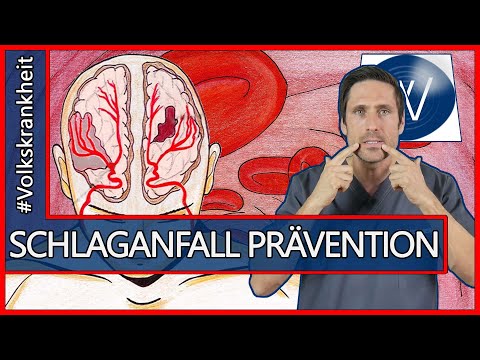 Volkskrankheit Schlaganfall: Wissen Sie wie bis zu 90% der Schlaganfälle vermeidbar sind? 10 Tipps!