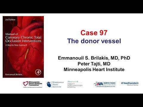 Case 97: Manual of CTO Interventions: The Donor Vessel