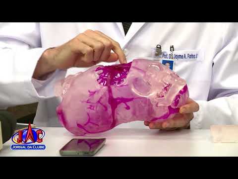 Gêmeas siamesas recebem alta do hospital após segunda cirurgia - Jornal da Clube (25/05/2018)