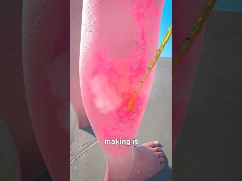 Don't Pee On A Jellyfish Sting 😯