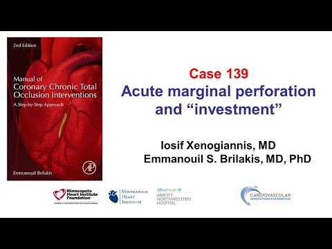Case 139: Manual of CTO PCI - Acute marginal perforation and subintimal plaque modification