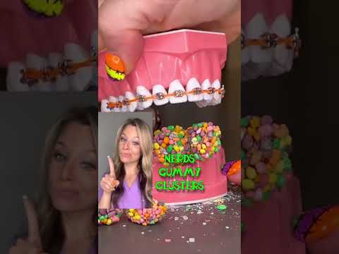 BEST AND WORST HALLOWEEN CANDIES FOR BRACES / TEETH 🎃👻🦷