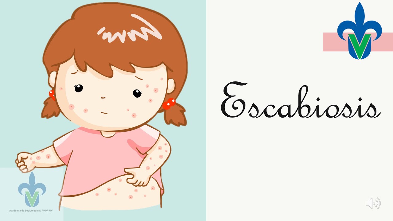 ¿Qué es la escabiosis o la sarna?