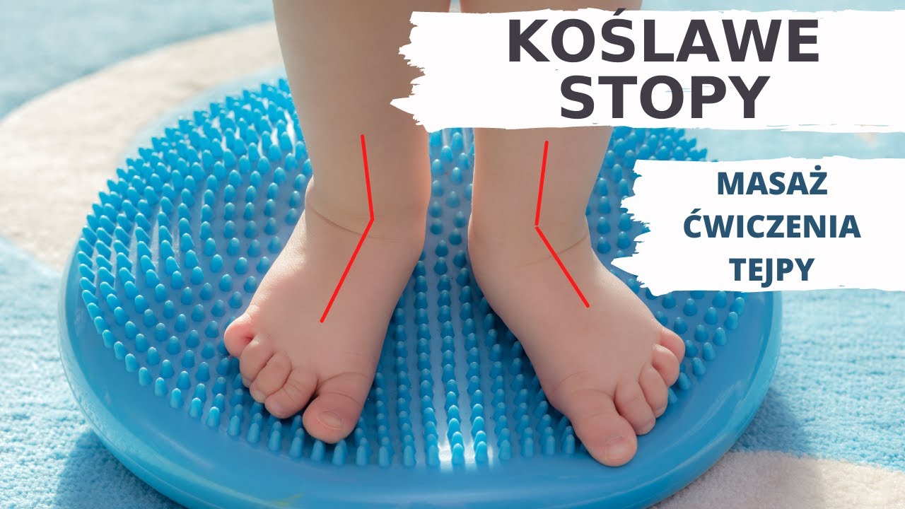 3 SPOSOBY NA STOPY PŁASKO-KOŚLAWE.