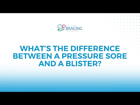Difference Between Pressure Sore and Blister I Clubfoot I Skin Care Webinar