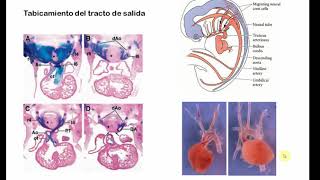 Desarrollo CV1 - Parte 3