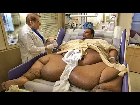 Can You Guess His Weight ? The Most Overweight People on The World