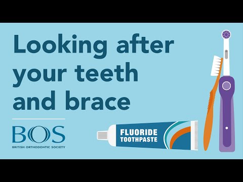 How to look after your teeth and brace
