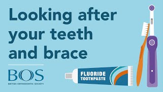 Braces Hints and Tips