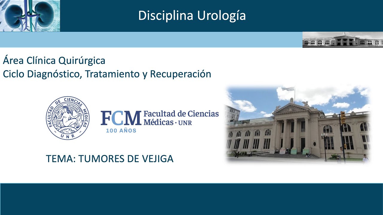 Tumores de Vejiga. Dr. Gustavo DELGADO