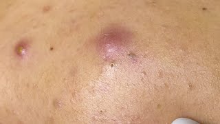 Satisfying Relaxing #ThuyTruong661