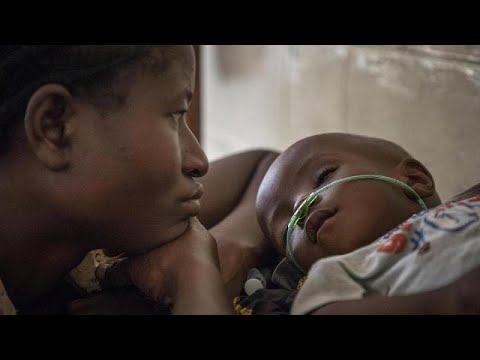 Minden 39. másodpercben meghal egy gyerek tüdőgyulladásban