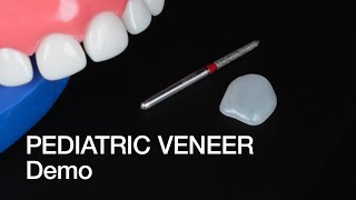 Pediatric Veneer – Demo