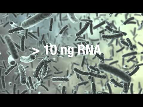 RNA-Seq Shows its Sensitive Side