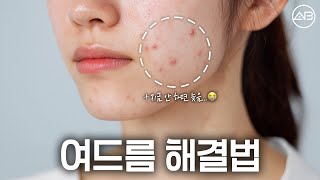 지긋지긋한 여드름 해결 해보자💥