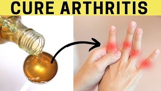 Get Rid Of Arthritis Bumps On Fingers and Joints Naturally | 3 Remedies for Arthritis
