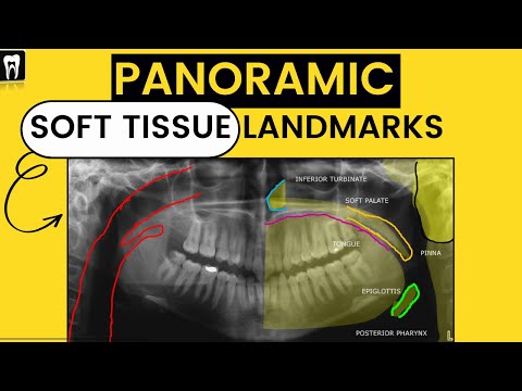 Panoramic Radiography landmark/Orthopantomogram(OPG)/ Soft tissue Landmark/Airway/Dental Radiology